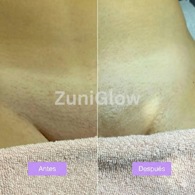 ZuniGlow™ Suero para la piel Cyperus Rotundus