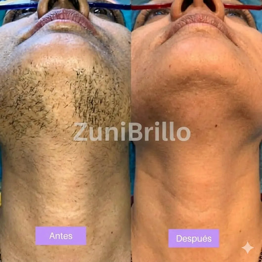 ZuniGlow™ Suero para la piel Cyperus Rotundus